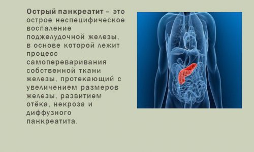 Перед началом лечения необходимо выяснить причину острого панкреатита