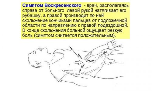 Схема определения симптома Воскресенского