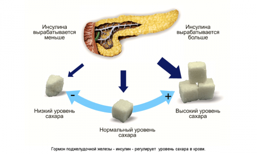 Совокупность панкреатита и сахарного диабета встречается довольно часто. Связано это с тем, что хроническое или острое воспаление разрушает β-клетки и приводит к инсулиновой недостаточности