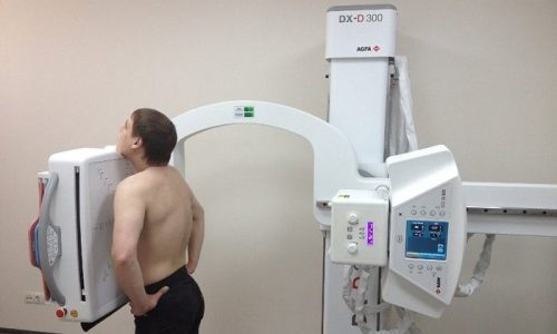 У тяжелых больных с панкреатитом возможно развитие пневмонии или плеврита, поэтому выявлять их признаки следует с помощью рентгенографии грудной клетки